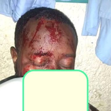 ph. journaliste agressé à goma bon Le journaliste Awa Jean De Dieu poignardé à Goma – L’UJPLA dénonce les menaces sur la liberté de la presse en RDC
