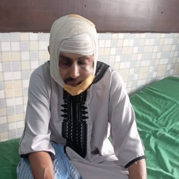 Maféré – Vol à main armée : le commerçant blessé, le malfrat tente de quitter le pays